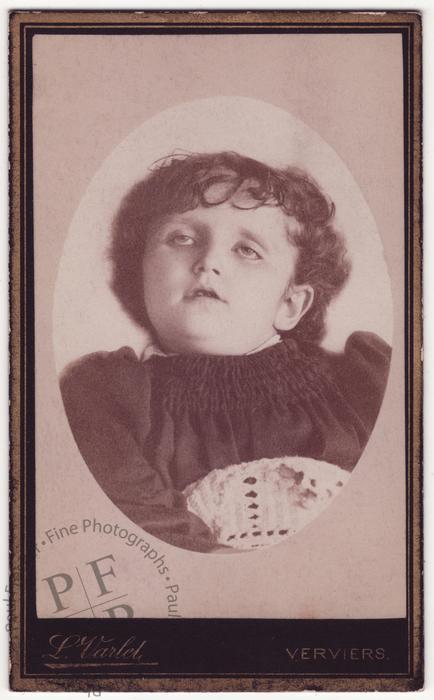 Child with open eyes