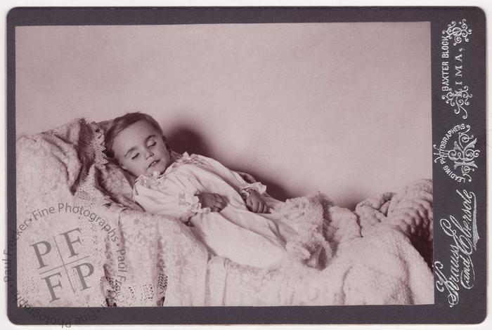 Child with prominent front teeth