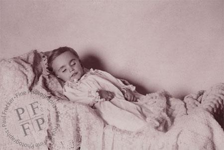 Child with prominent front teeth